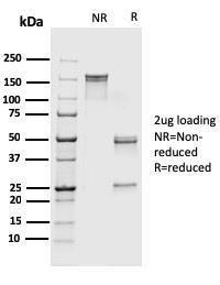 Anti-S100A4 Mouse Recombinant Antibody [clone: rS100A4/1481]