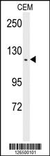 Anti-TSHZ2 Rabbit Polyclonal Antibody