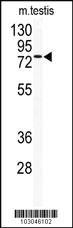 Anti-TLK2 Rabbit Polyclonal Antibody