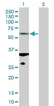 Anti-TUBA1C Rabbit Polyclonal Antibody