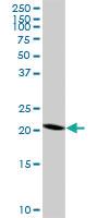 Anti-RNF182 Mouse Polyclonal Antibody