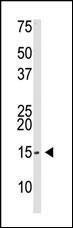 Anti-SUMO2, SUMO3 Rabbit Polyclonal Antibody (AP (Alkaline Phosphatase))