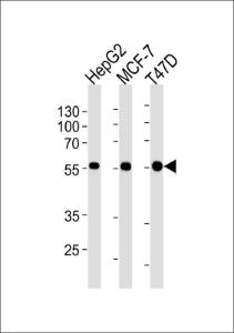 Anti-ALDH6A1 Mouse Monoclonal Antibody (HRP (Horseradish Peroxidase)) [clone: 147CT8.3.4]