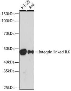 Western blot analysis of extracts of various cell lines, using Anti-Integrin linked ILK Antibody [ARC1037] (A308006) at 1:1000 dilution. The secondary Antibody was Goat Anti-Rabbit IgG H&L Antibody (HRP) at 1:10000 dilution