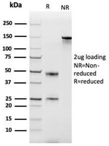 SDS-PAGE analysis of Anti-MCP2 Antibody [CCL8/3686] under non-reduced and reduced conditions; showing intact IgG and intact heavy and light chains, respectively. SDS-PAGE analysis confirms the integrity and purity of the antibody