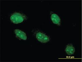 Anti-ANGPTL7 Mouse Monoclonal Antibody [clone: 3F1]