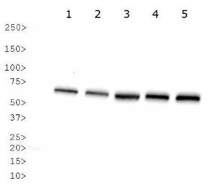 Anti-GLI1 Rabbit Polyclonal Antibody (DyLight® 550)