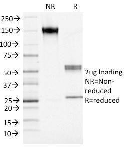 SDS-PAGE analysis of Anti-S100A4 Antibody [S100A4/1482] under non-reduced and reduced conditions; showing intact IgG and intact heavy and light chains, respectively. SDS-PAGE analysis confirms the integrity and purity of the Antibody