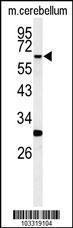 Anti-RIPK3 Rabbit Polyclonal Antibody