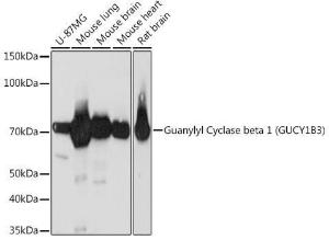 Western blot analysis of extracts of various cell lines, using Anti-GUCY1B3 Antibody [ARC2071] (A308007) at 1:1,000 dilution. The secondary antibody was Goat Anti-Rabbit IgG H&L Antibody (HRP) at 1:10,000 dilution.