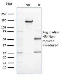 SDS-PAGE analysis of Anti-ZNF690 Antibody [ZSCAN29/2610] under non-reduced and reduced conditions; showing intact IgG and intact heavy and light chains, respectively. SDS-PAGE analysis confirms the integrity and purity of the antibody