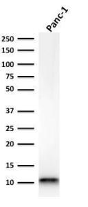 Anti-S100A4 Mouse Recombinant Antibody [clone: rS100A4/1481]