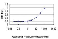 Anti-ANGPTL7 Mouse Monoclonal Antibody [clone: 3F1]