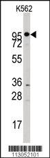 Anti-RAF1 Rabbit Polyclonal Antibody