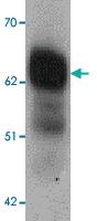 Anti-DYRK2 Rabbit Polyclonal Antibody