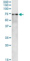 Anti-SF1 Mouse Monoclonal Antibody