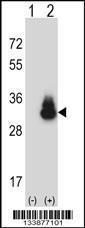 Anti-CEACAM3 Rabbit Polyclonal Antibody (PE (Phycoerythrin))