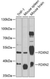 Western blot analysis of extracts of various cell lines, using Anti-FOXN2 Antibody (A12088) at 1:1,000 dilution. The secondary antibody was Goat Anti-Rabbit IgG H&L Antibody (HRP) at 1:10,000 dilution.