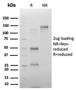 SDS-PAGE analysis of Anti-PHF10 Antibody [PCRP-PHF10-2A10] under non-reduced and reduced conditions; showing intact IgG and intact heavy and light chains, respectively. SDS-PAGE analysis confirms the integrity and purity of the antibody