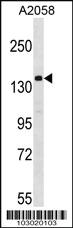 Anti-ULK1 Rabbit Polyclonal Antibody