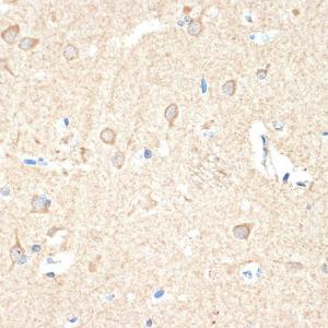 Immunohistochemistry analysis of paraffin-embedded human brain tissue using Anti-GUCY1B3 Antibody [ARC2071] (A308007) at a dilution of 1:100 (40x lens). Perform microwave antigen retrieval with 10 mM Tris/EDTA buffer pH 9.0 before commencing with IHC staining protocol.