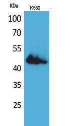 Western blot analysis of K562 cells using Anti-CD177 Antibody