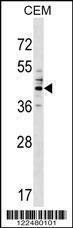 Anti-CEACAM6 Rabbit Polyclonal Antibody (AP (Alkaline Phosphatase))