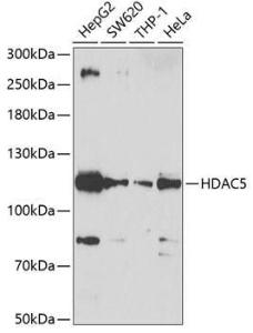 Western blot analysis of extracts of various cell lines, using Anti-HDAC5 Antibody (A12089) at 1:1000 dilution. The secondary Antibody was Goat Anti-Rabbit IgG H&L Antibody (HRP) at 1:10000 dilution. Lysates/proteins were present at 25 µg per lane