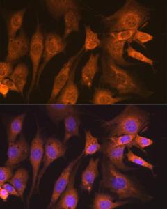 Immunofluorescence analysis of NIH-3T3 cells using Anti-GUCY1B3 Antibody [ARC2071] (A308007) at a dilution of 1:100 (40x lens). DAPI was used to stain the cell nuclei (blue).