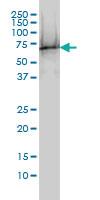 Anti-TUBA1C Mouse Monoclonal Antibody [clone: 1D2-H5]