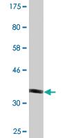 Anti-NDUFA8 Mouse Monoclonal Antibody [clone: 2E10]