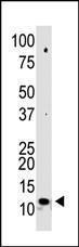 Anti-SUMO2, SUMO3 Rabbit Polyclonal Antibody (APC (Allophycocyanin))