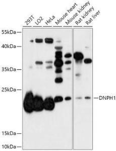 Western blot analysis of extracts of various cell lines, using Anti-RCL Antibody (A306783) at 1:1,000 dilution