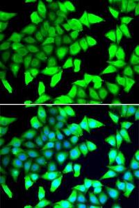 Immunofluorescence analysis of A549 cells using Anti-HDAC5 Antibody (A12089). DAPI was used to stain the cell nuclei (blue)