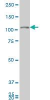 Anti-GUCY2C Mouse Monoclonal Antibody [clone: 2H8]