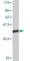 Anti-SP100 Mouse Polyclonal Antibody