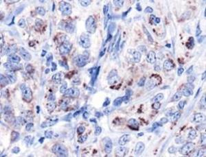 Anti-HSPD1 Rabbit Polyclonal Antibody