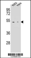 Anti-CPB1 Rabbit Polyclonal Antibody (PE (Phycoerythrin))