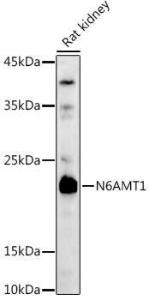 Anti-HEMK2/N6AMT1 antibody