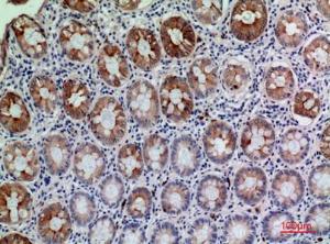 Immunohistochemical analysis of paraffin-embedded human colon using Anti-CD177 Antibody