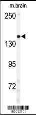 Anti-ULK2 Rabbit Polyclonal Antibody