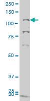 Anti-GUCY2C Mouse Monoclonal Antibody [clone: 1E1]