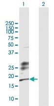 Anti-KLRG1 Rabbit Polyclonal Antibody