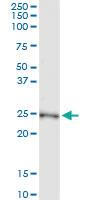 Anti-NME5 Polyclonal Antibody Pair