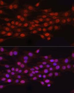 Anti-HEMK2/N6AMT1 antibody