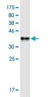 Anti-SLC30A5 Mouse Monoclonal Antibody [clone: 2E10]