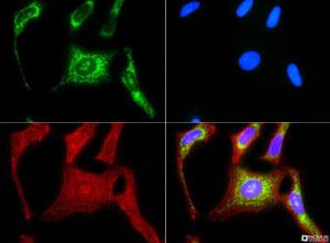 Anti-HSPD1 Rabbit Polyclonal Antibody