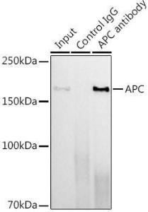 Immunoprecipitation analysis of 600µg extracts of mouse lung using 3µg of Anti-APC Antibody [ARC0346] (A306785). This Western blot was performed on the immunoprecipitate using Anti-APC Antibody [ARC0346] (A306785) at a dilution of 1:500.