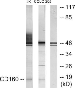 Anti-CD160 Rabbit Polyclonal Antibody