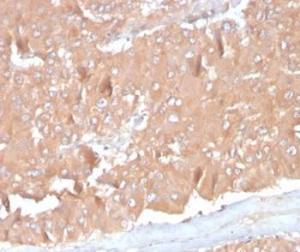 Immunohistochemical analysis of formalin-fixed, paraffin-embedded human adrenal gland tissue using Anti-MCP2 Antibody [CCL8/3686]